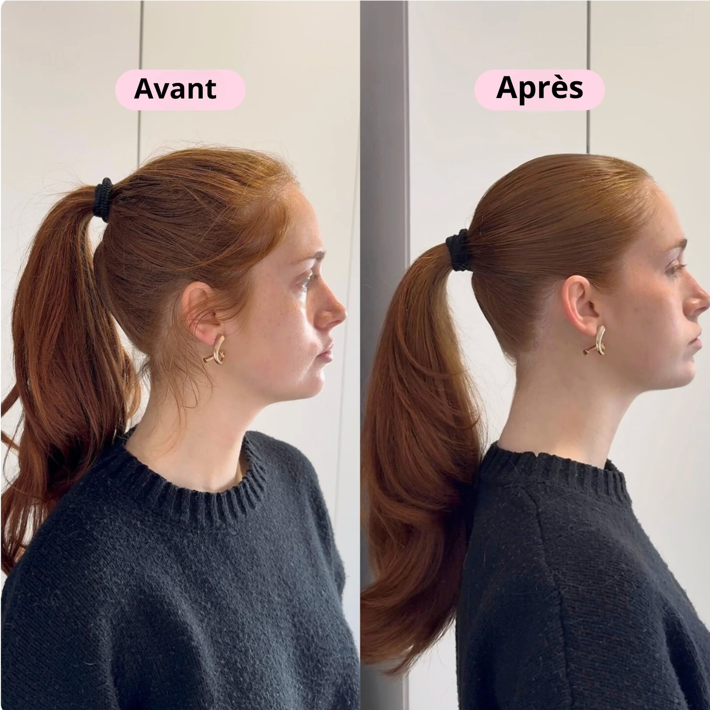 Trenxia™ — Brosse Démêlante Hydratante à Spray